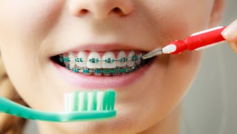 6 imprescindibles para limpiar los dientes con frenos o alineadores