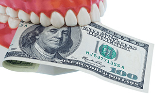 ¿Cómo conseguir un implante dental más barato? Aquí hay 5 formas