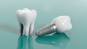 El costo de un solo diente e implantes de boca completa